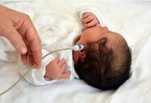 غربالگری شنوایی بیش از ۸۸ هزار نوزاد خوزستانی در سال گذشته  