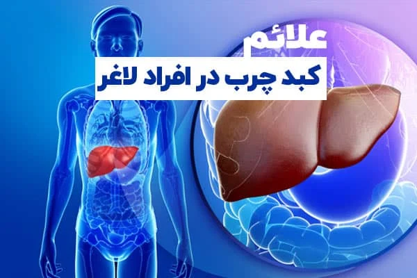 لاغری